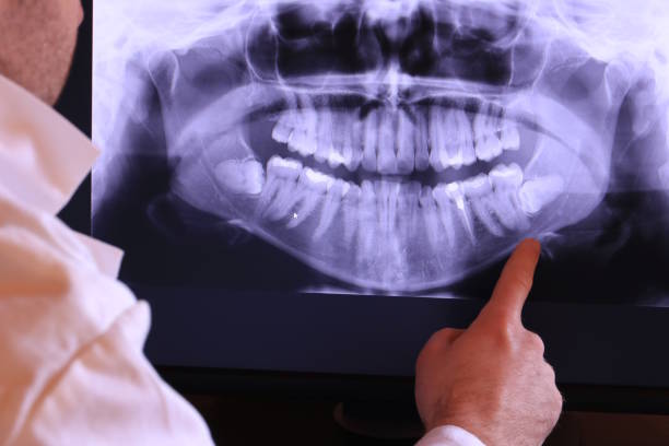 Best Emergency Wisdom Teeth Removal in Newbern, TN