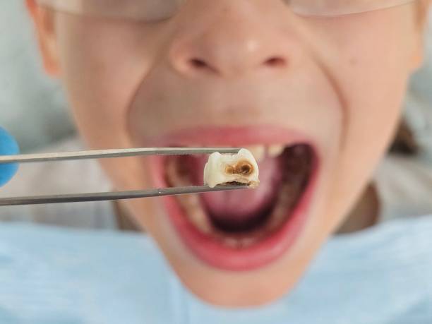 Best Weekend Emergency Dentist in Newbern, TN